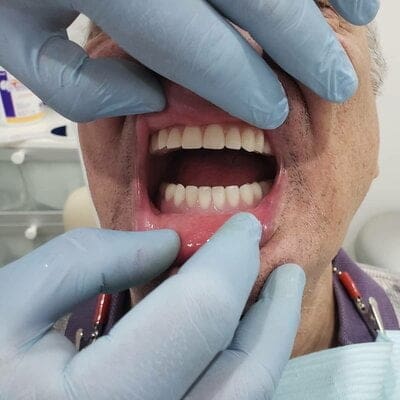 دندانسازی سلیمی|تورنتو